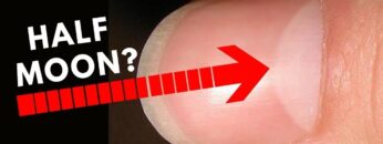 Do You Have Half Moon Shape On Your Nails?? -Palmistry