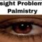 Eyesight Problems in Palmistry
